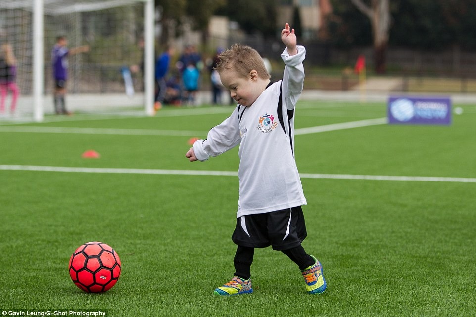 Uma criança com síndrome de down brinca em um campo de futebol. 
