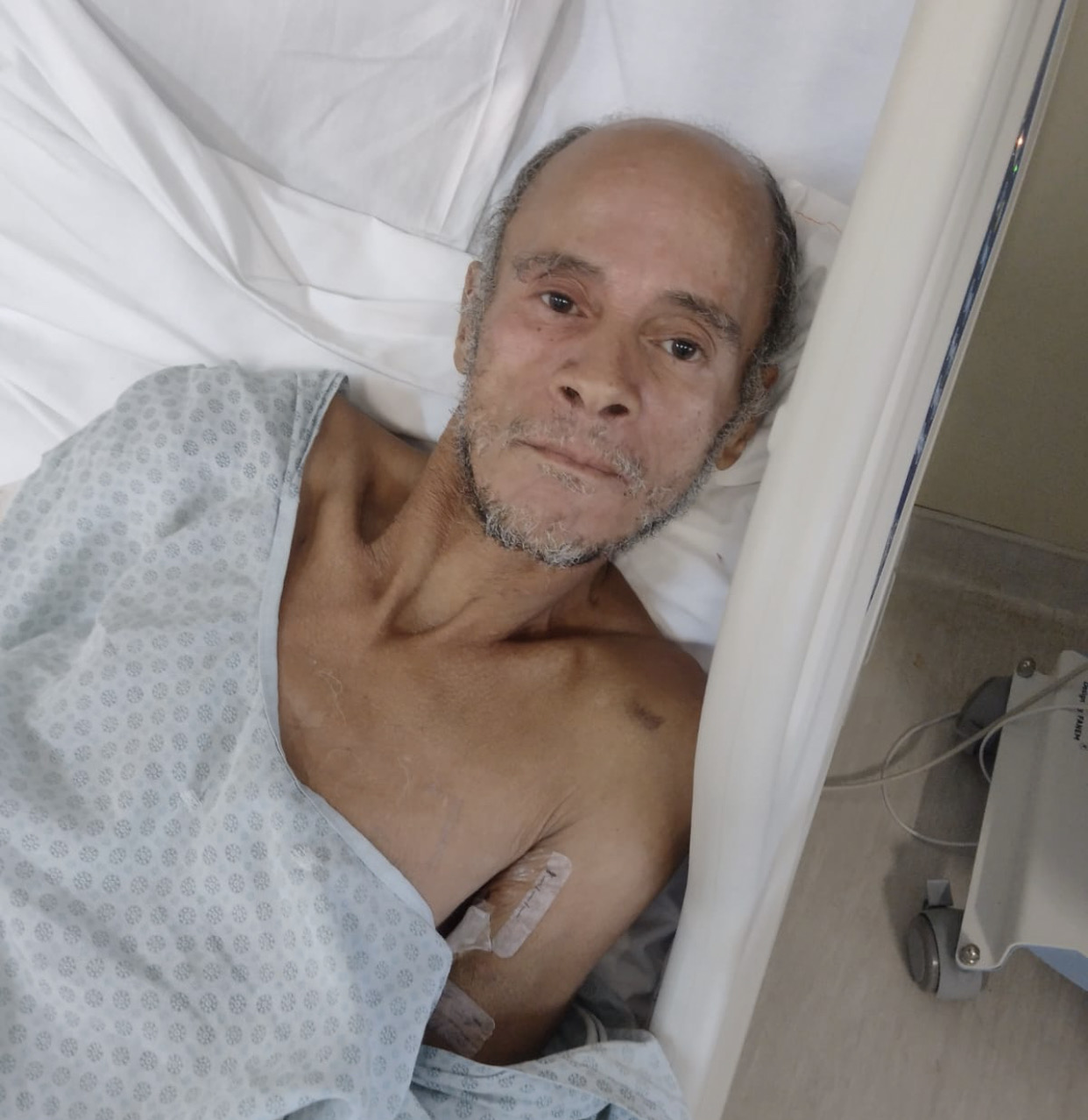 Paciente pardo e calvo, do sexo masculino, está deitado sobre uma maca hospitalar. Está usando avental do hospital.